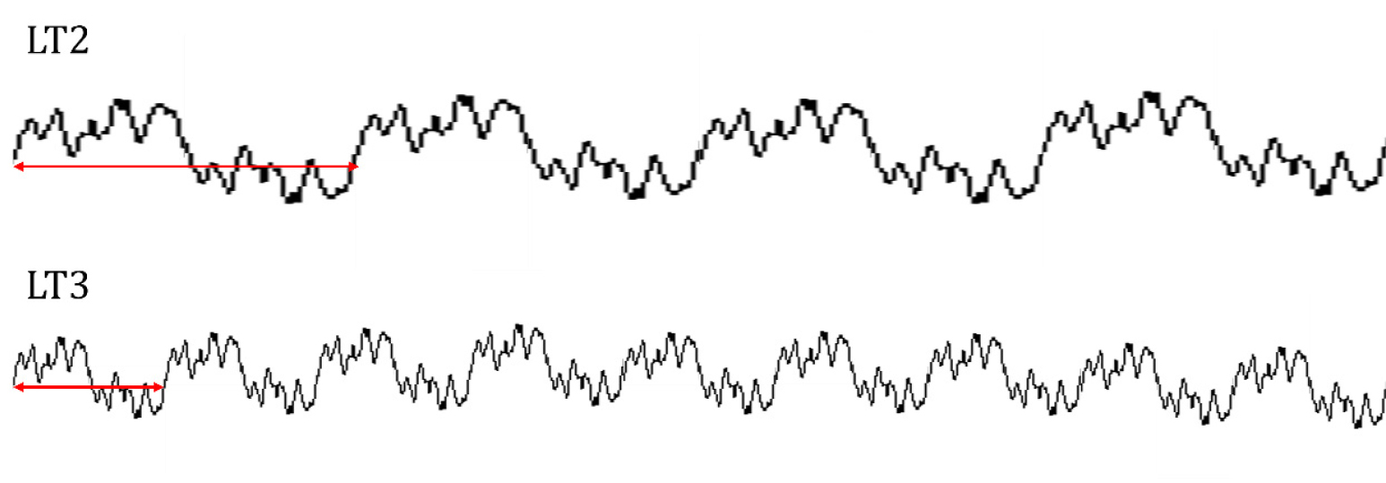 Fractal Dimension Analysis of the Surface Softness of Facial Tissues